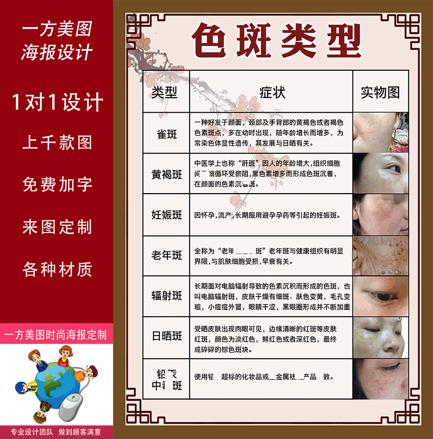 色斑的类型美容院激光祛斑祛痘色斑海报宣传画挂画装饰画广告展板