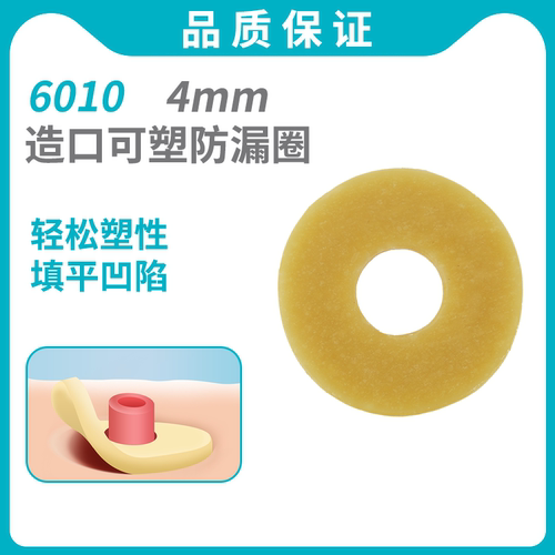 4mm造口防漏圈填平凹陷预防渗漏