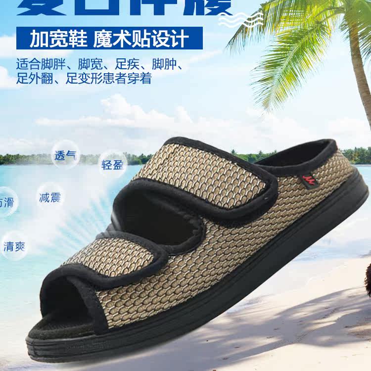 受伤脚肿布鞋受伤脚肿拇指外翻
