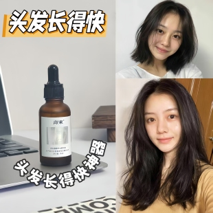 青束头发增长液快速短发变长发际线加快生长增密浓密精油护发男女