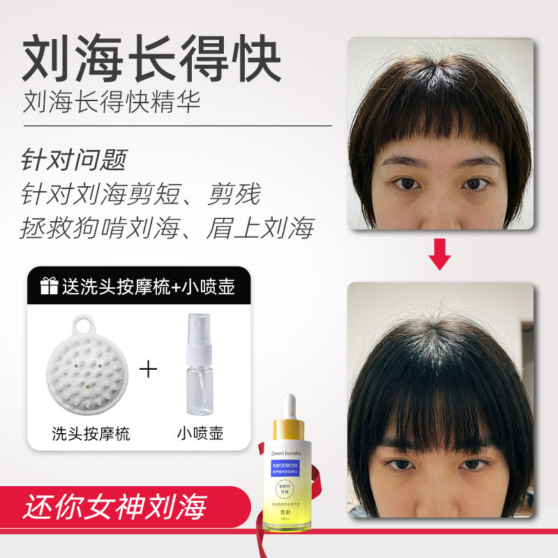 青束刘海快速生长液快速长长增长液拯救刘海尴尬期快速变长