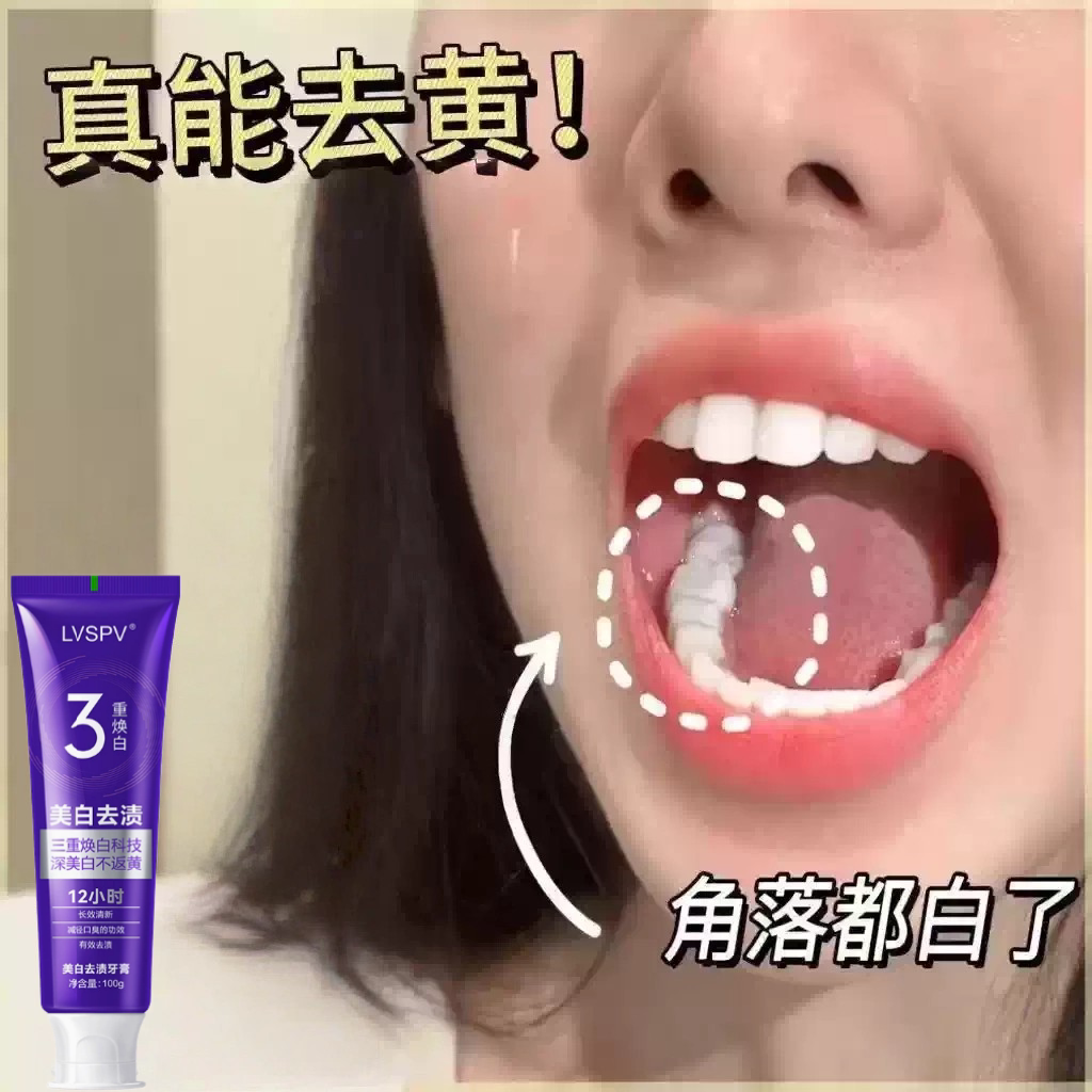 美白去渍牙膏清新口气溶菌酶牙膏冷光修白牙膏亮白牙齿口腔护理