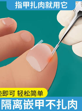 甲沟嵌甲矫正炎脚趾甲贴片正甲贴指甲长肉里修脚趾甲专用刀器套卷