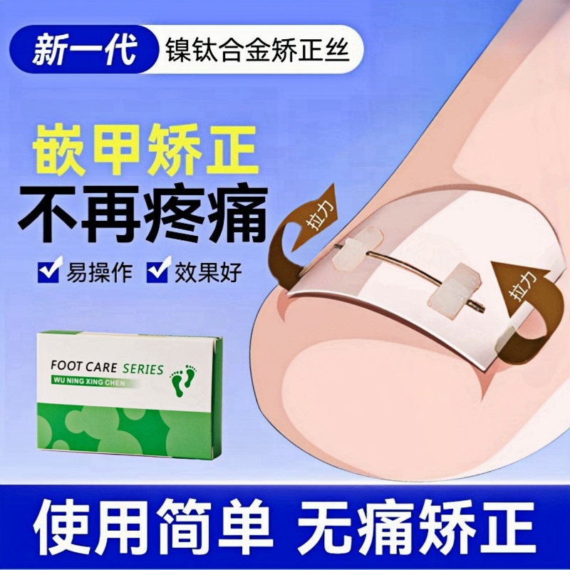 镍钛甲沟炎矫正神器嵌甲卷甲矫正钢丝脚趾甲长肉里专用正甲贴片 - 实物图