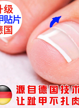 正甲贴脚趾甲卷嵌甲甲沟矫正器指甲长肉里专用修脚拉拉炎贴片神器