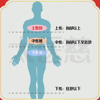 上热下寒体质足灸粉 上焦热下焦寒 涌泉艾灸贴脐灸粉 足底贴100g