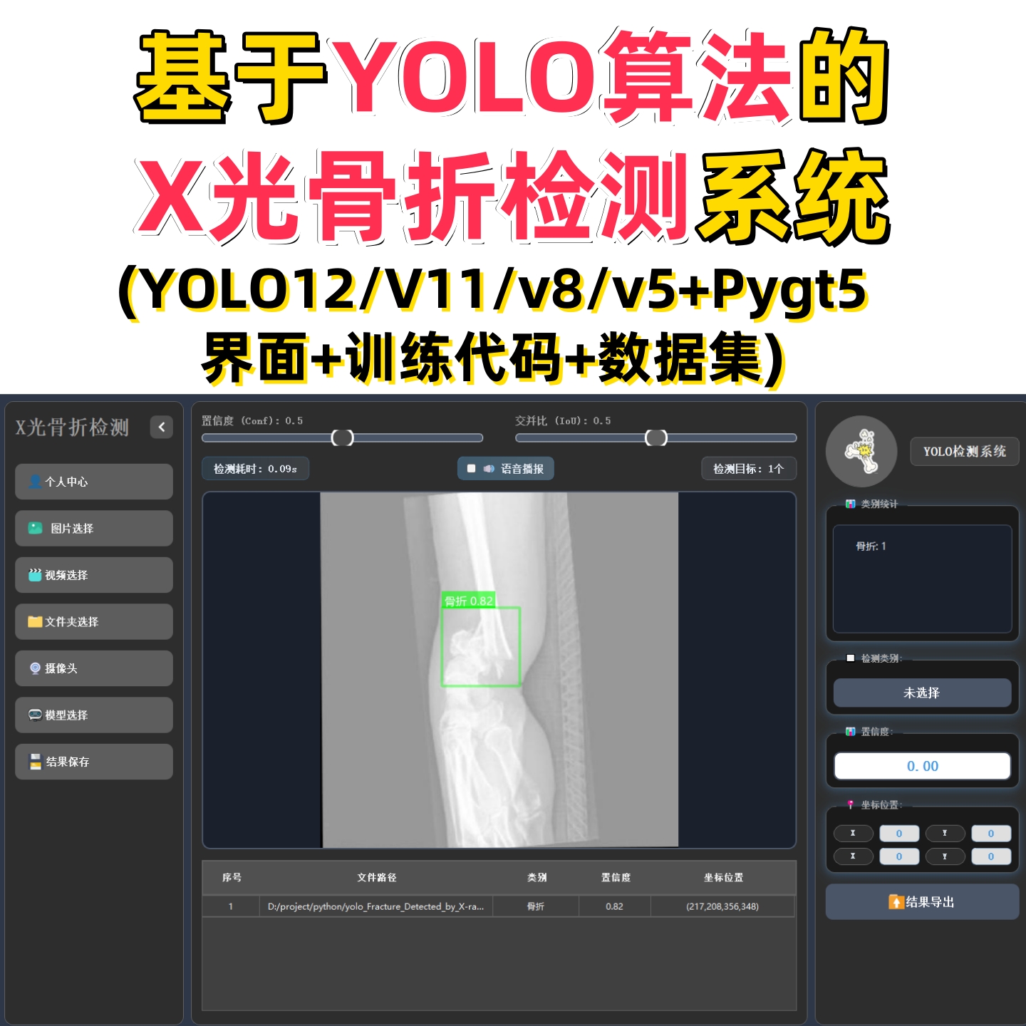 基于深度学习的X光骨折检测系统(YOLOv12/v11/v8/v5模型+数据集)
