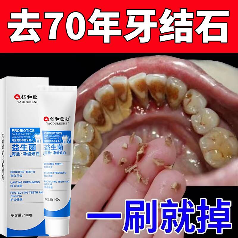 美白牙膏去黄去除器溶解牙石减轻烟渍垢牙结石洗去口臭男士女专用