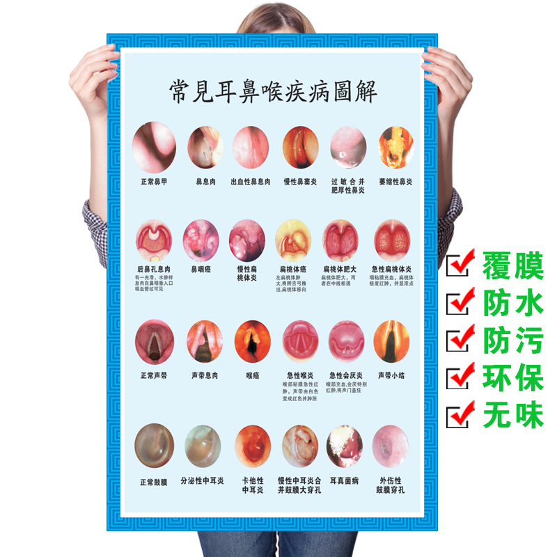 医院医学文化知识挂画耳鼻喉科解剖示意图墙贴纸治疗图片挂图海报