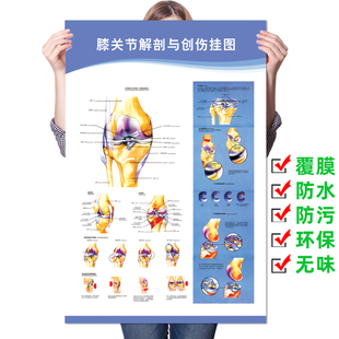 医学关节解剖图壁画《膝关节解剖与创伤挂图》骨科宣传健康海报
