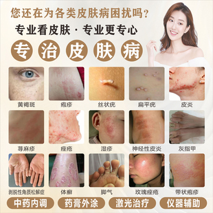 皮肤病墙贴纸皮肤疾病常见图谱医院治疗皮肤科图例挂图宣传海报