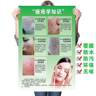 青春痘产生的原因痘痘类型治疗皮肤面部色斑痤疮示意图美容院挂图