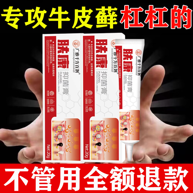 肤康抑菌膏干痒膏皮肤腿脚痒杀菌湿泡藓热瘙痒消红疹止痒膏正品