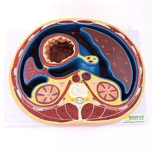 ENOVO颐诺人体腹部断面模型平网膜网膜囊孔结构解剖标本CTMRI影像