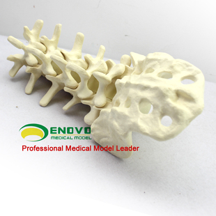 骨科术前Sawbone人体腰椎模型人工骨模型骨科手术仿真骨演示