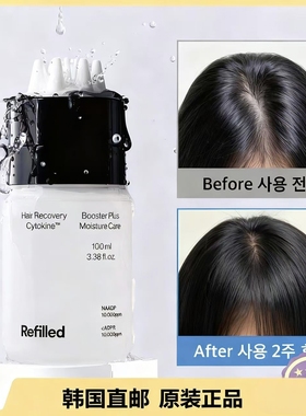韩国直邮化解OY双一位Refilled防tuo发头皮精华蓬松孕产妇可
