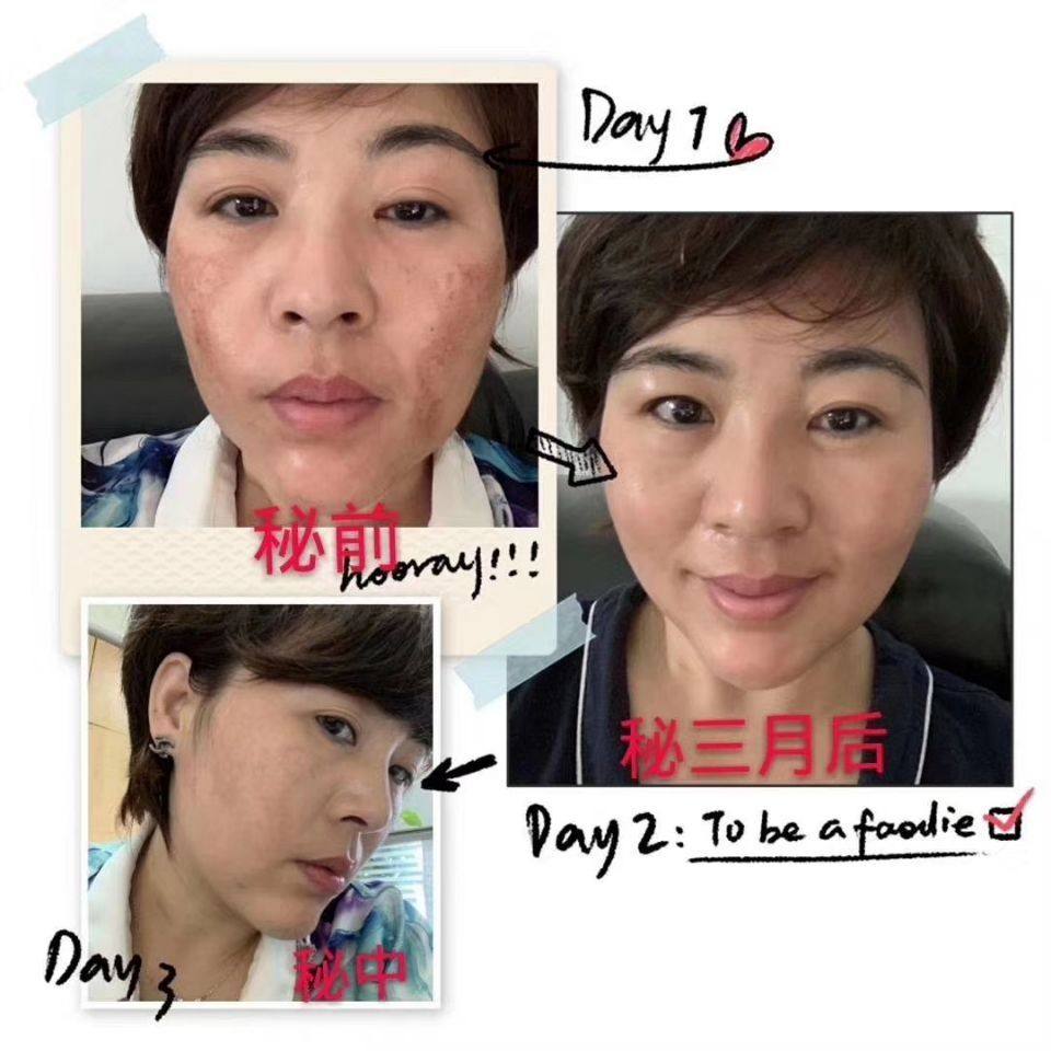 秘制早晚面霜淡化妊娠黑斑老年斑痘印去黄提亮紧致保湿小秘靓颜