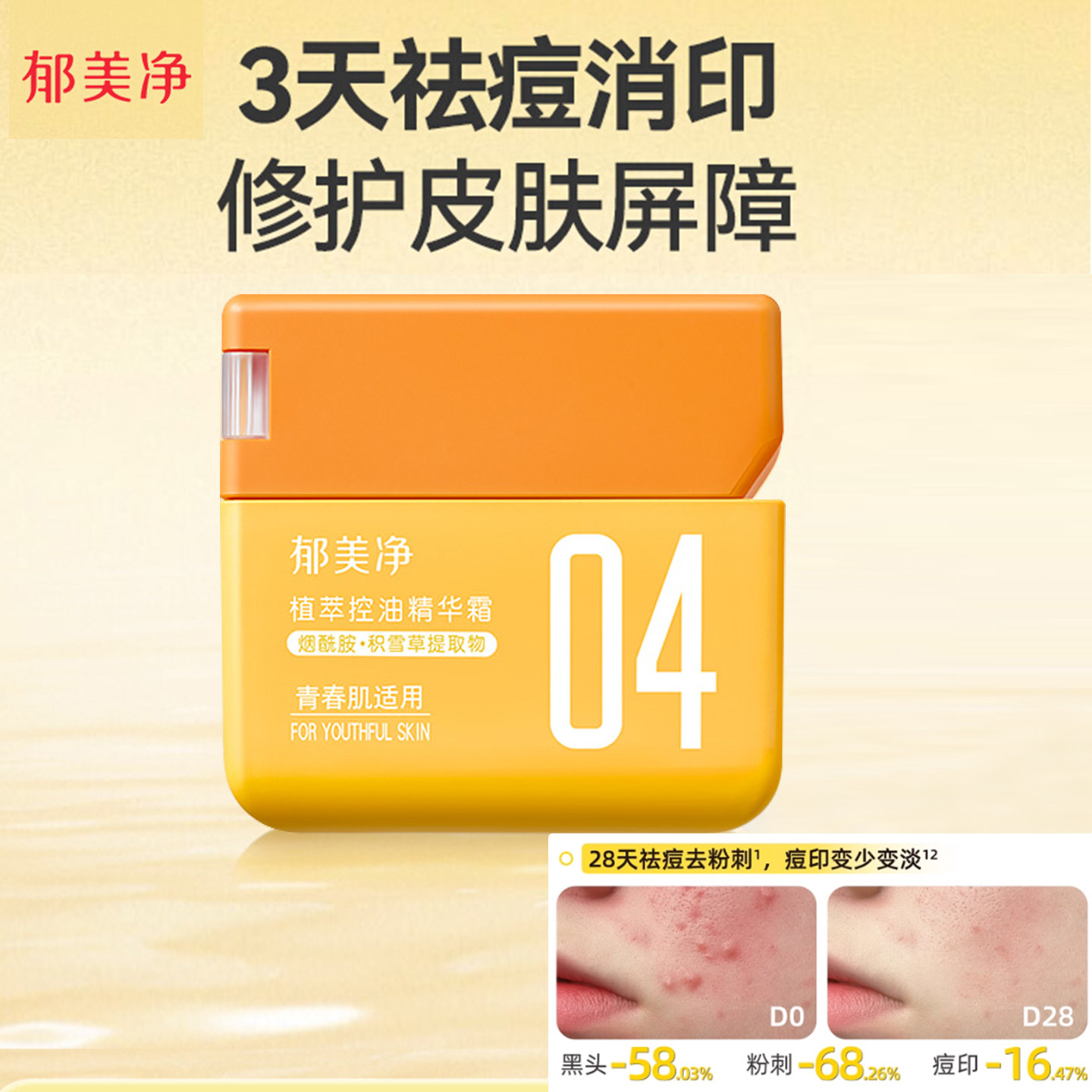 郁美净青少年控油祛痘精华霜淡化痘印缓解暗沉光滑肌肤润肤乳面霜