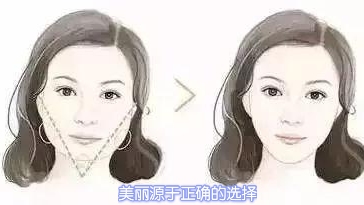 改善面部脂肪多咬肌不对称精华