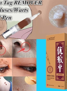 Body-Warts-Removal-Cream Skin-Tag-Remover Foot-Care 5ML 1-Bo
