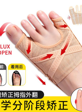 脚趾矫正器通用小趾内翻矫大脚骨