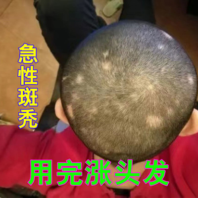 天目湖防脱育发液苗坚洗