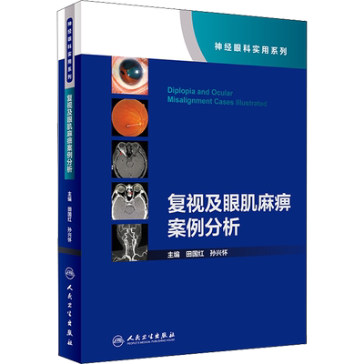 正版现货 复视及眼肌麻痹案例分析 人民卫生出版社 田国红,孙兴怀 编 眼科学