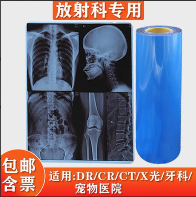 医用打印胶片 干式高清蓝基喷墨 放射X光DR CT核磁共振蓝片卷装