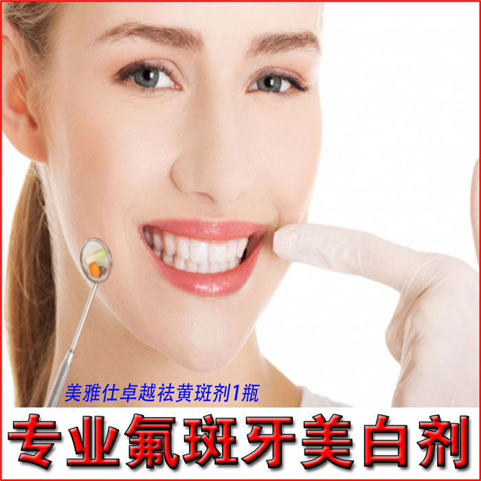 快速水质氟斑牙去黄褐色斑 美雅仕牙齿美白剂凝胶 不是牙贴洗牙粉