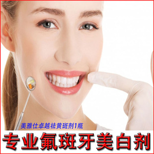 美雅仕卓越祛黄斑剂 牙齿美白速效去除氟斑牙黄斑牙锈牙膏清洁剂