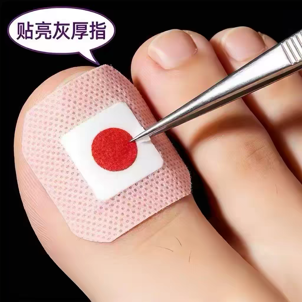 【香港断货王】灰趾增厚正品专用灰指贴发黄粉碎甲脚趾手指甲专用