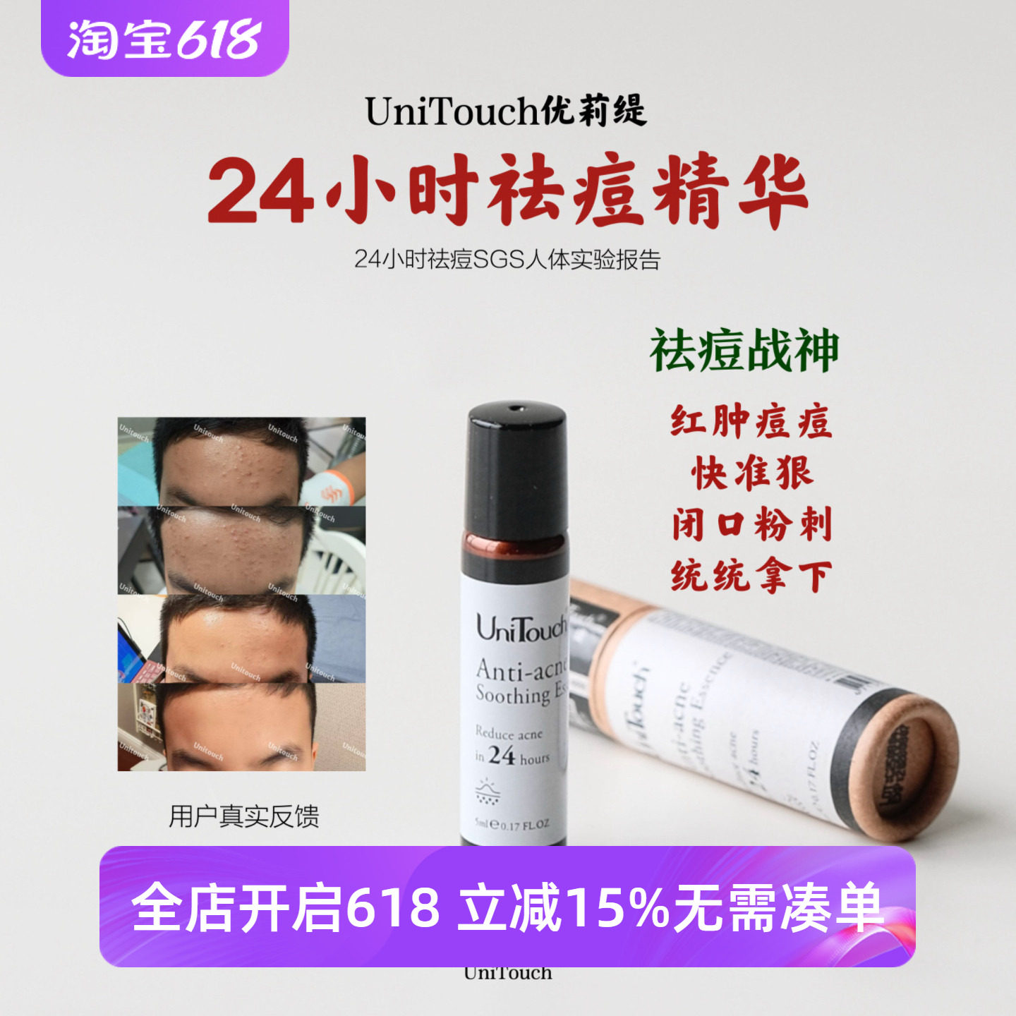 顺丰 祛痘绝了| UniTouch优莉缇24小时祛痘精华液油好用1天4次