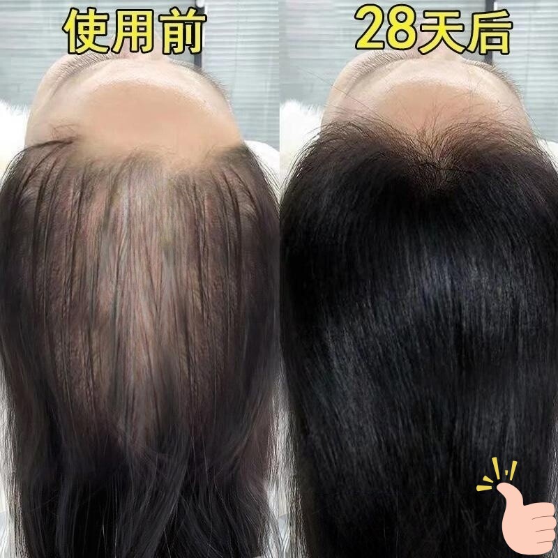 【不长我吃掉】头发自然生长速度洗发水