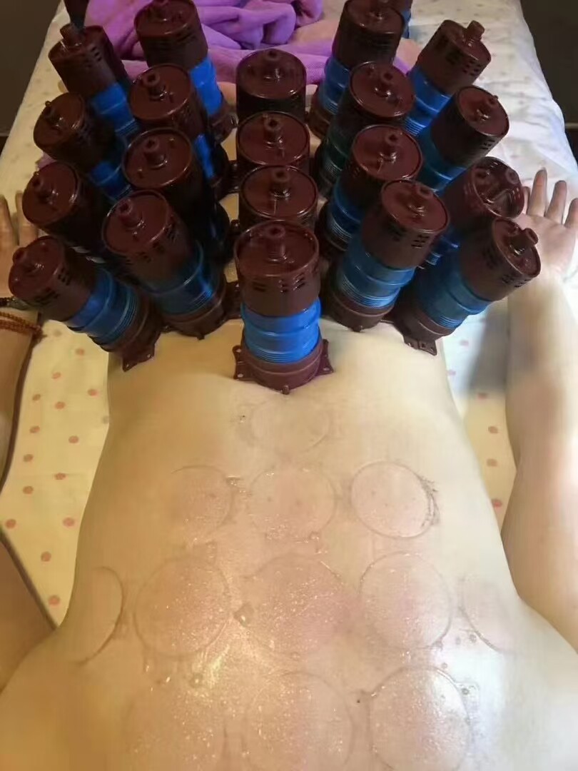 艾灸盒宫廷灸无烟随身灸家用艾条艾柱温灸暖宫姨妈神器具艾熏蒸仪