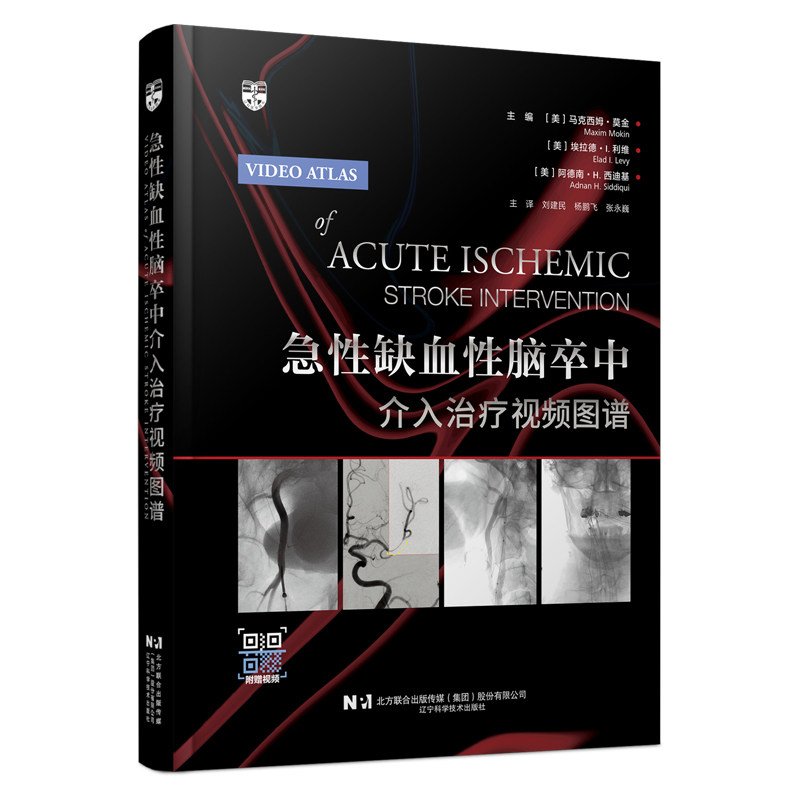 急性缺血性脑卒中介入治疗视频图谱 血管内治疗技术动脉粥样硬化静脉性脑卒中复杂病例处理要点高清视频手术过程临床神经影像学