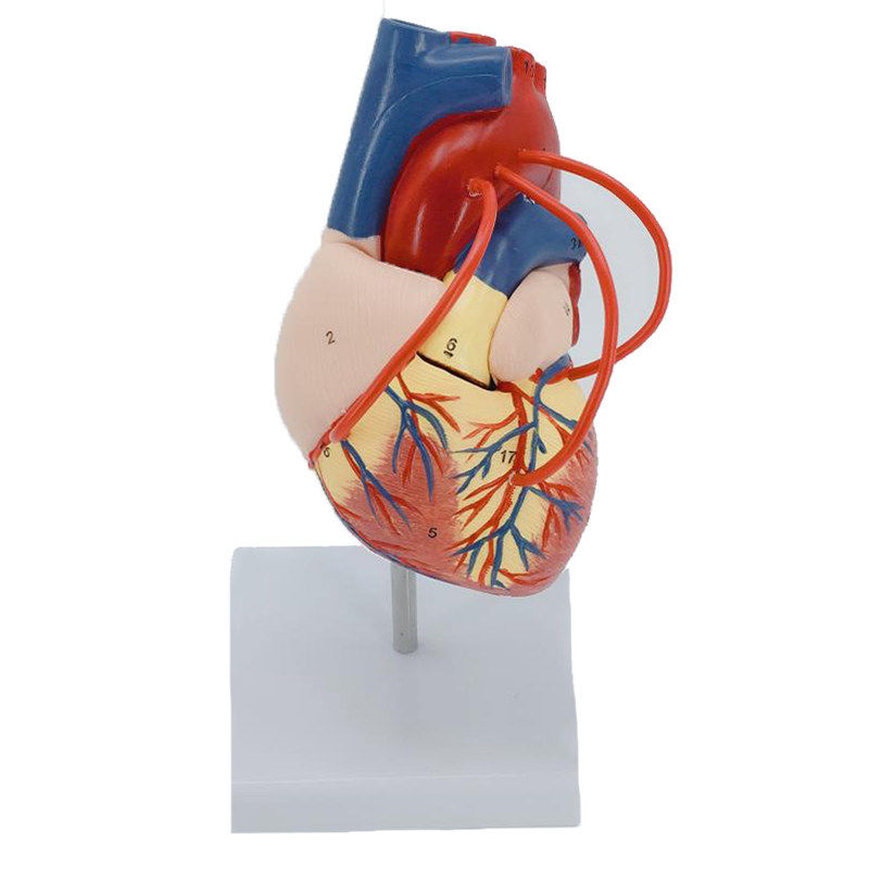 人体心脏搭桥模型 病理心脏演示模型 人体内脏模型 心脏解剖模型