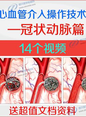 心血管介入操作技术冠状动脉造影介入冠脉介入穿刺血流动力学检测