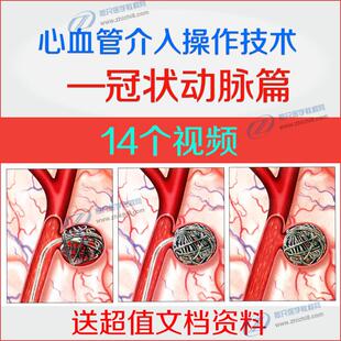 心血管介入操作技术冠状动脉造影介入冠脉介入穿刺血流动力学检测