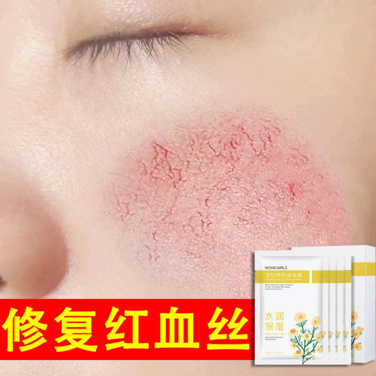 面膜补水修复红血丝敏感肌增厚角贴片面膜