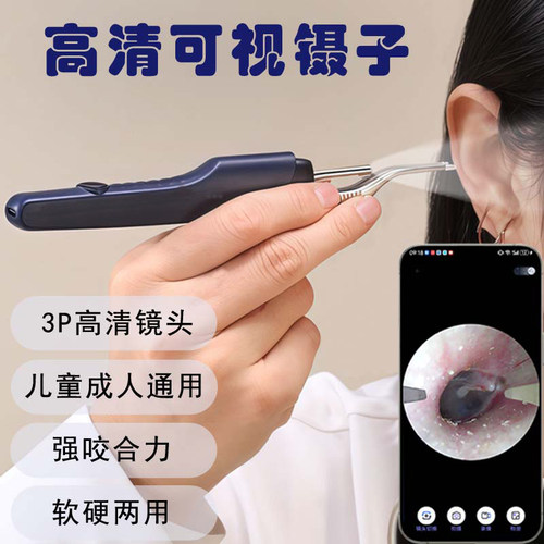 智能可视挖耳勺带镊子宝宝掏耳神器专业采耳工具高清可视耳屎镊子