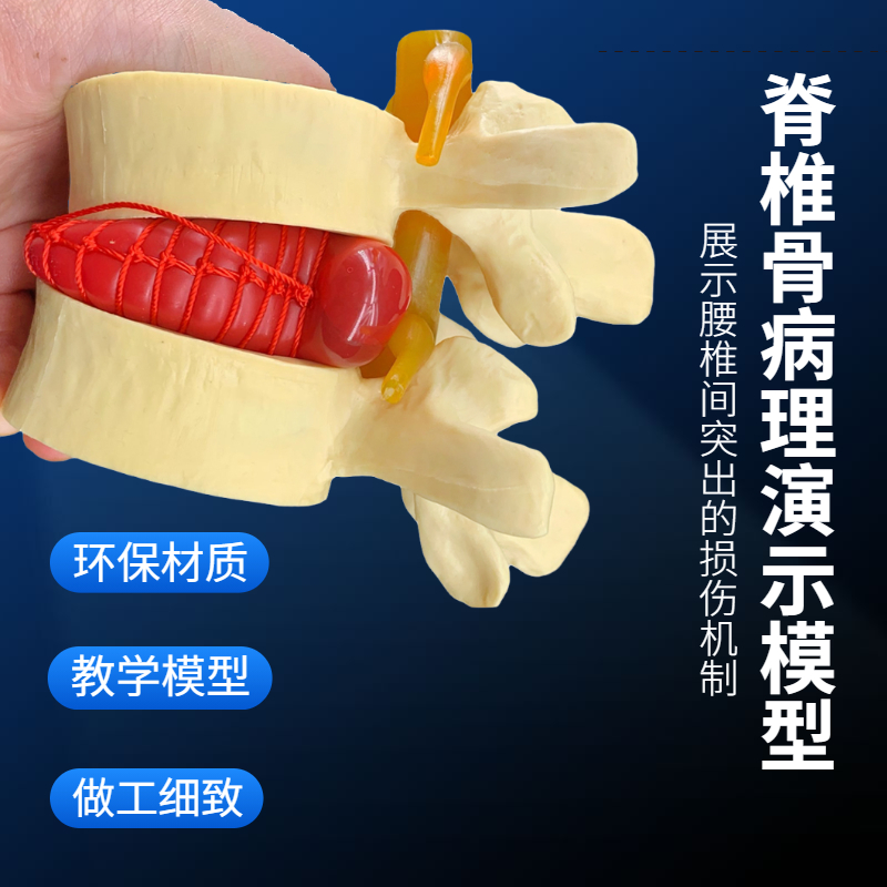 医用人体腰椎间盘演示模型 腰椎模型 脊柱模型 脊椎模型 骨科模型 玩具/童车/益智/积木/模型 其他模型玩具 原图主图