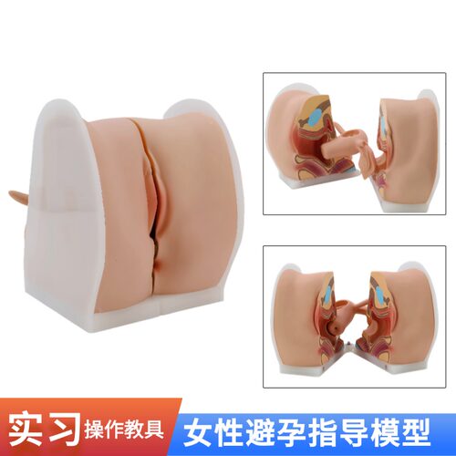 高品质妇科避孕指导模型
