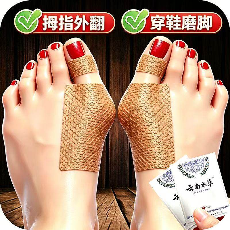 【正品】严重大脚骨外翻贴凸出脚趾重叠关节畸形肿胀疼痛专用贴