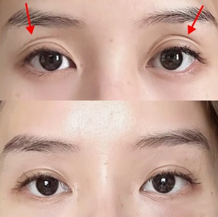 草本眼窝凹陷修复精华 改善泪沟眼袋饱满眼部精油加强版