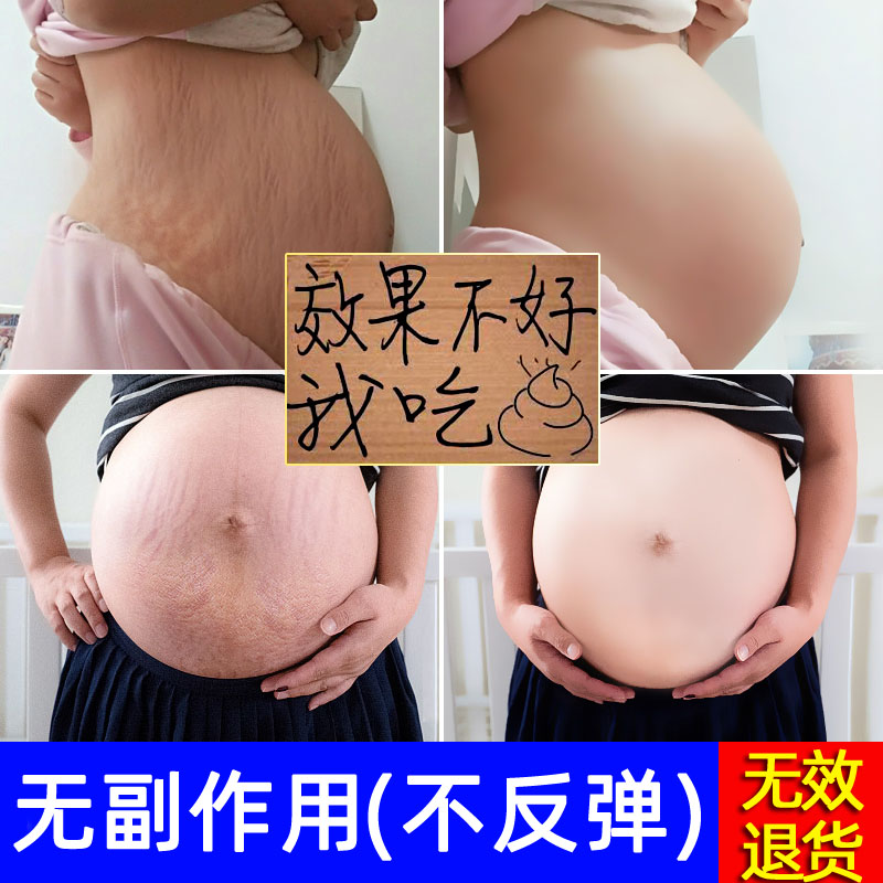 [SimpleXMLElement Object妊娠纹护理]孕妇专用产后去除妊娠纹修复消除预防仪月销量0件仅售69元