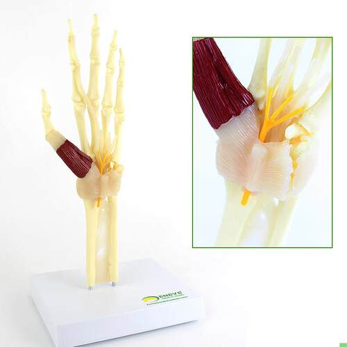 ENOVO颐诺 人体腕关节综合征模型 腕管综合征 正中神经 肘关节 桡