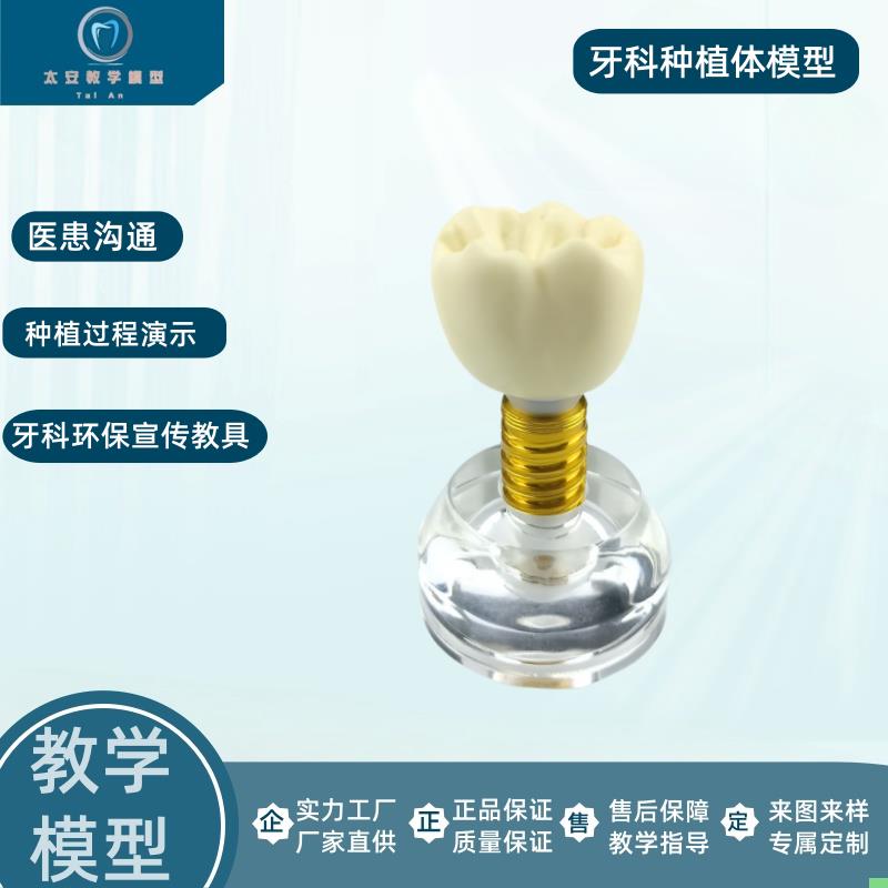 牙科口腔材料透明水晶种植体模型螺丝可拆卸医患沟通