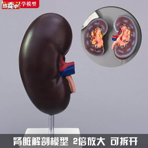 肾解剖模型人体肾脏H结构切面泌尿系统内脏器官医学教学模具玩具