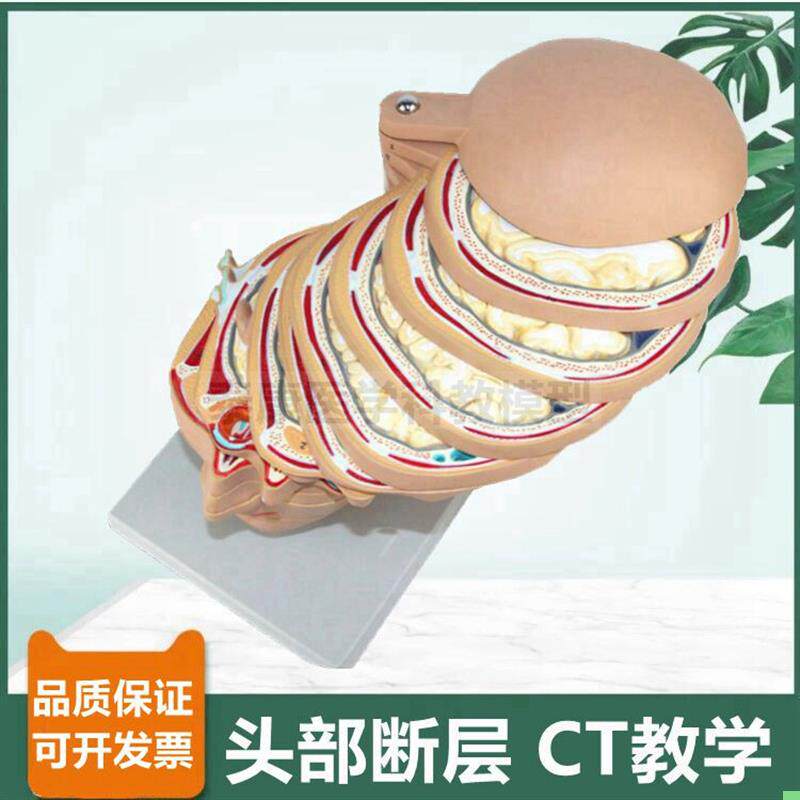 头部横截面模型颅脑断层颈部CT影像教学用脑部冠状切临床医用面部