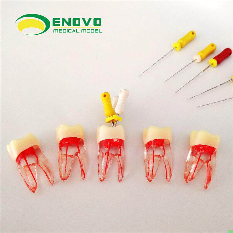 ENOVO正品根管仿真离体 RCT根管教学练习牙体牙髓根管器械操